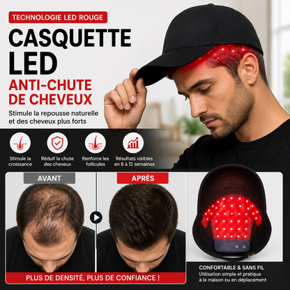 Casquette de Luminothérapie LED – Stimule la Repousse Naturelle des Cheveux