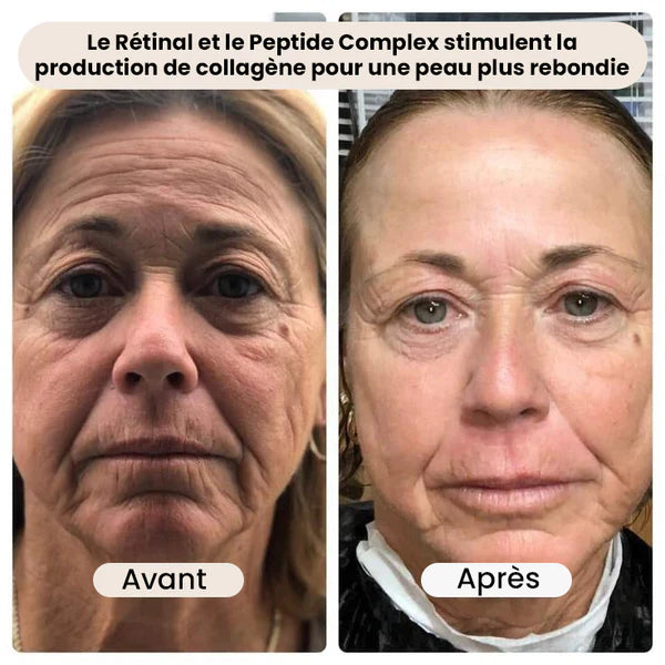 Retinal Shot Tightening Booster