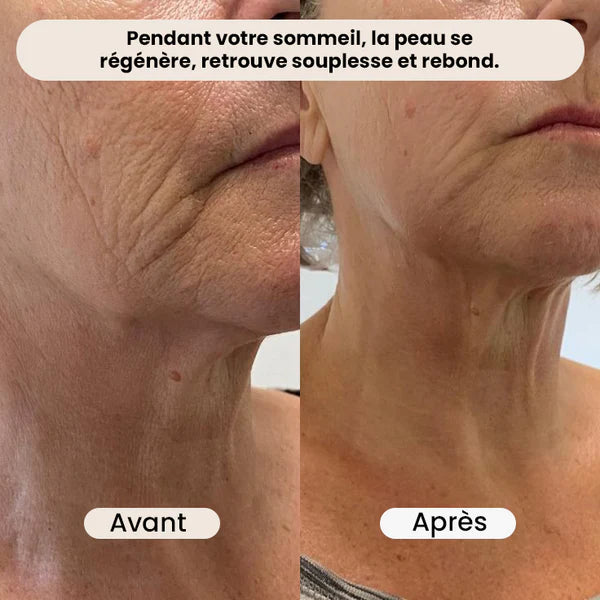 Retinal Shot Tightening Booster