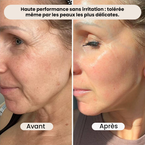 Retinal Shot Tightening Booster