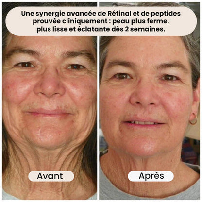 Retinal Shot Tightening Booster