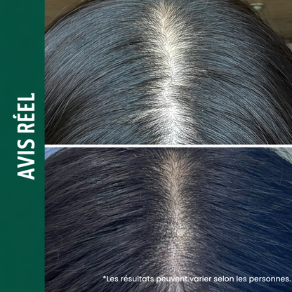 VIVELAB™ – Sérum Cuir Chevelu Anti-Chute à la Biotine & Peptides