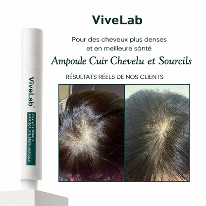 VIVELAB™ – Sérum Cuir Chevelu Anti-Chute à la Biotine & Peptides