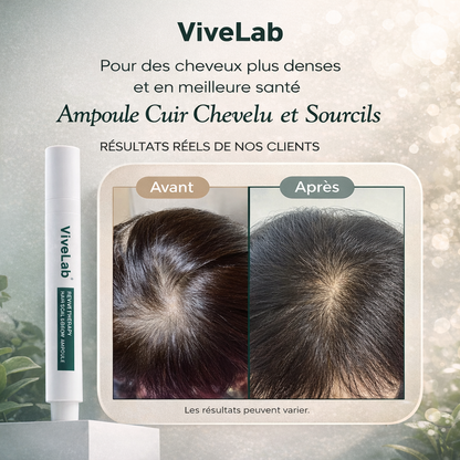 VIVELAB™ – Sérum Cuir Chevelu Anti-Chute à la Biotine & Peptides