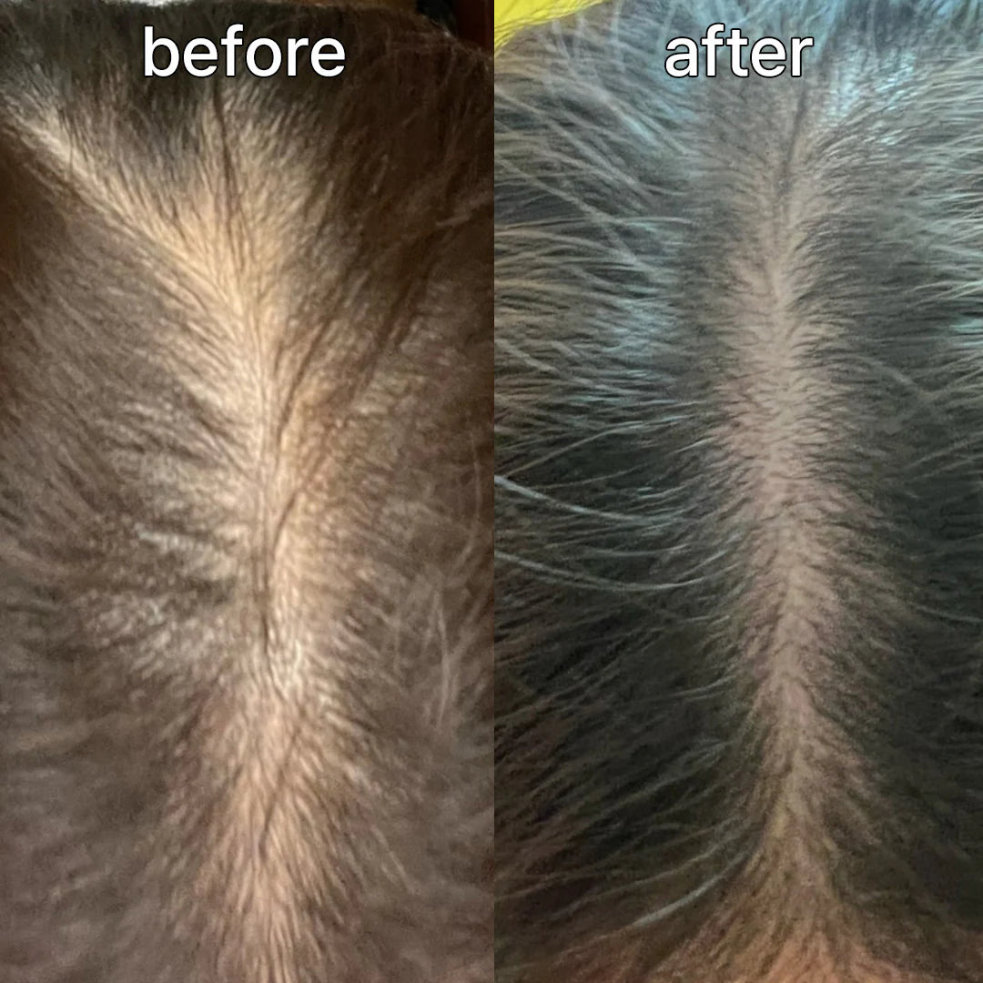 VIVELAB™ – Sérum Cuir Chevelu Anti-Chute à la Biotine & Peptides