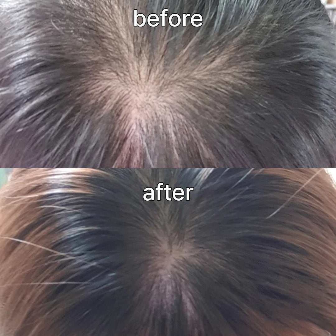 VIVELAB™ – Sérum Cuir Chevelu Anti-Chute à la Biotine & Peptides
