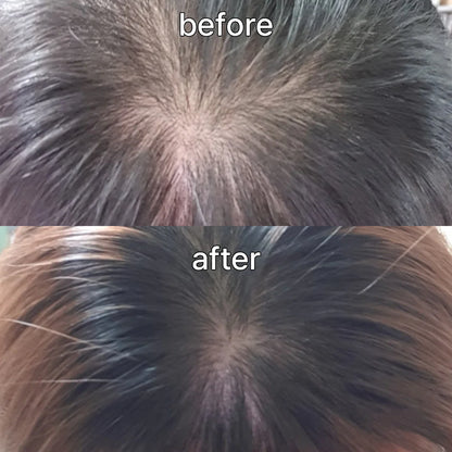 VIVELAB™ – Sérum Cuir Chevelu Anti-Chute à la Biotine & Peptides