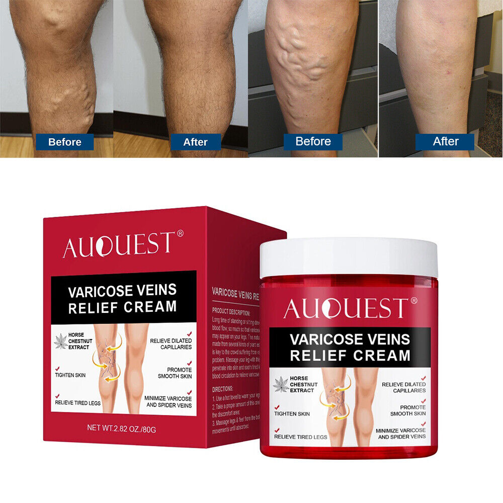 Auquest Crème anti-varices, traitement des varices pour jambes